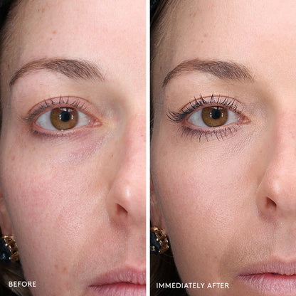 Total Eye® 3-in-1 Renewal Therapy SPF 35